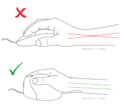 natürliche Handstellung bei der Arbeit mit einer vertikalen Maus Beim Arbeiten mit einer Vertikalmaus ist die Stellung der Hand zum Unterarm natürlich, bei der normalen Maus ist sie leicht verdreht.