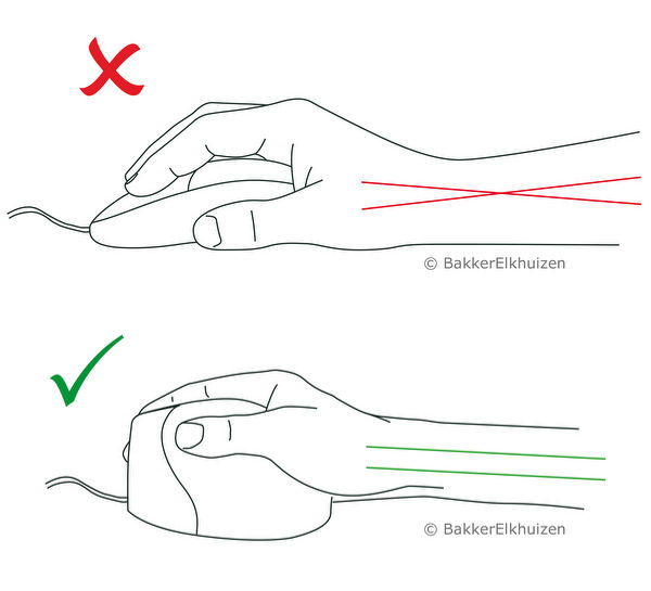 Beim Arbeiten mit einer Vertikalmaus ist die Stellung der Hand zum Unterarm natürlich, bei der normalen Maus ist sie leicht verdreht.